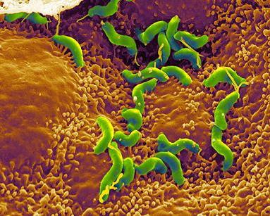 Helicobacter a eradikační terapie