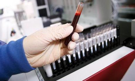 Jaký je krevní test, pokud jsou ALT a AST zvýšeny?